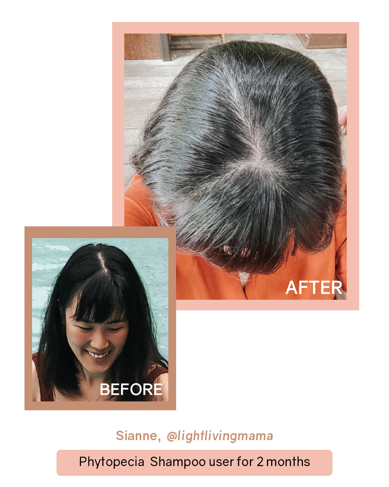 Phytopecia+ Hair Boosting Series